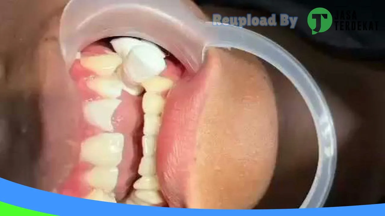 Gambar Asia Dental Care di Padangsidimpuan, Sumatera Utara ke 1