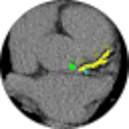 Review From ASEP SUKMANA